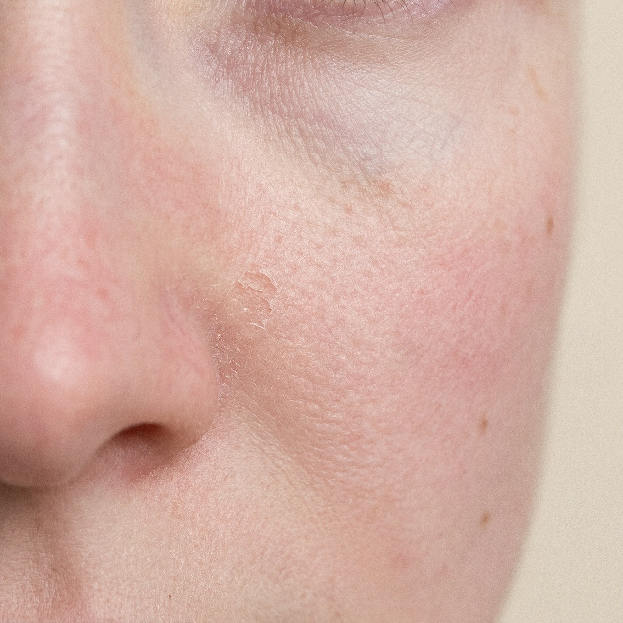 Trockene Haut - Ikram Bellanova Cosmetics